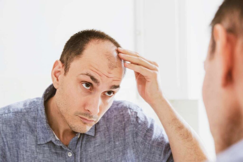 A balding man examining his head in the mirror