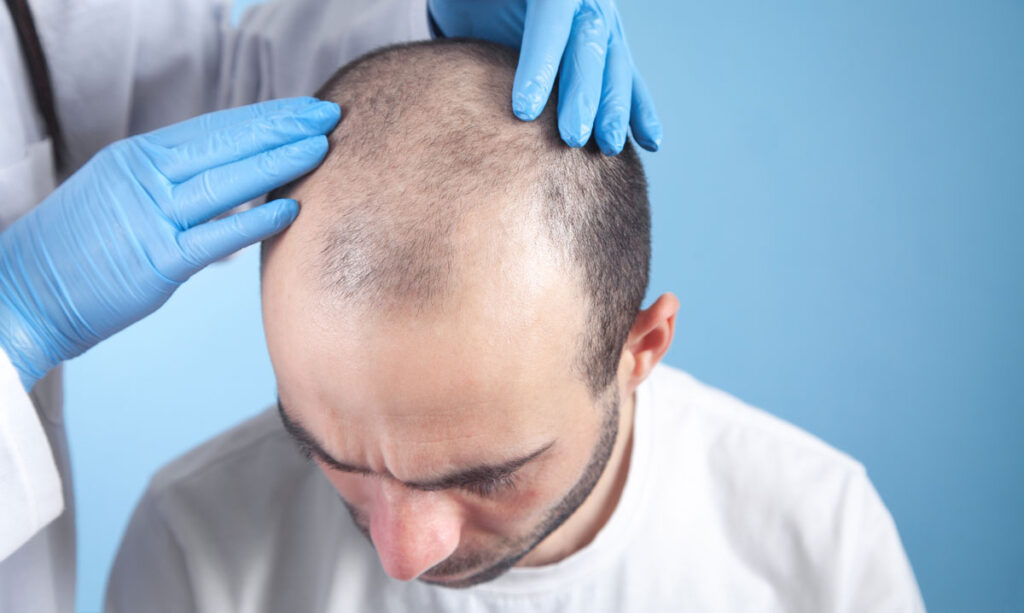 A doctor examining the head of a balding man