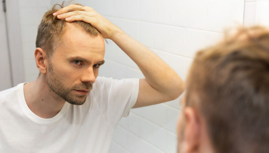 A man looking in the mirror at his receding hairline